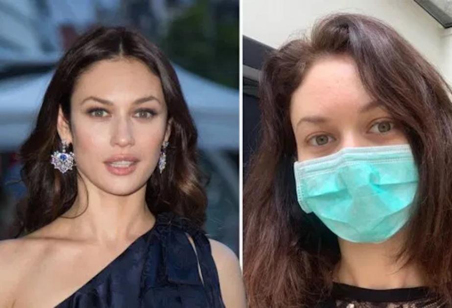 Анна куриленко актриса фото до и после пластики