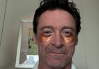 Και ο Hugh Jackman χρησιμοποιεί eye patches - Μάθε τα οφέλη τους - Κεντρική Εικόνα