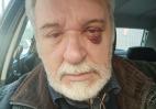 Ο Τάσος Χαλκιάς με νέα δήλωση είπε πότε συνέβη ο τραυματισμός του - Κεντρική Εικόνα